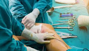 Ortho surgeon in Madurai